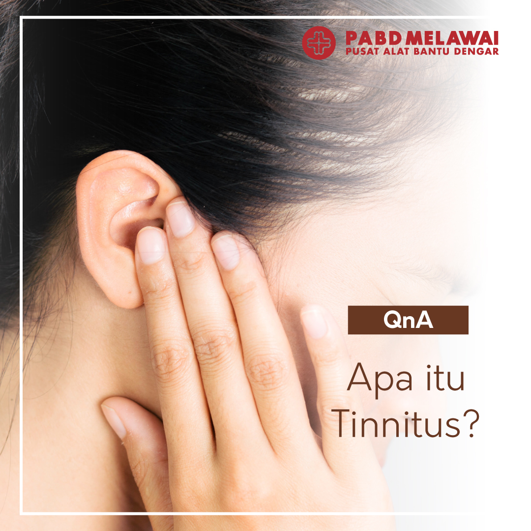 Apa itu Tinnitus?