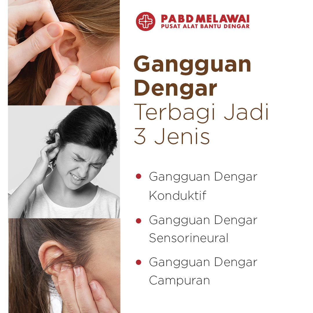 Ini dia jenis gangguan pendengaran yang umum dialami oleh penderita gangguan dengar