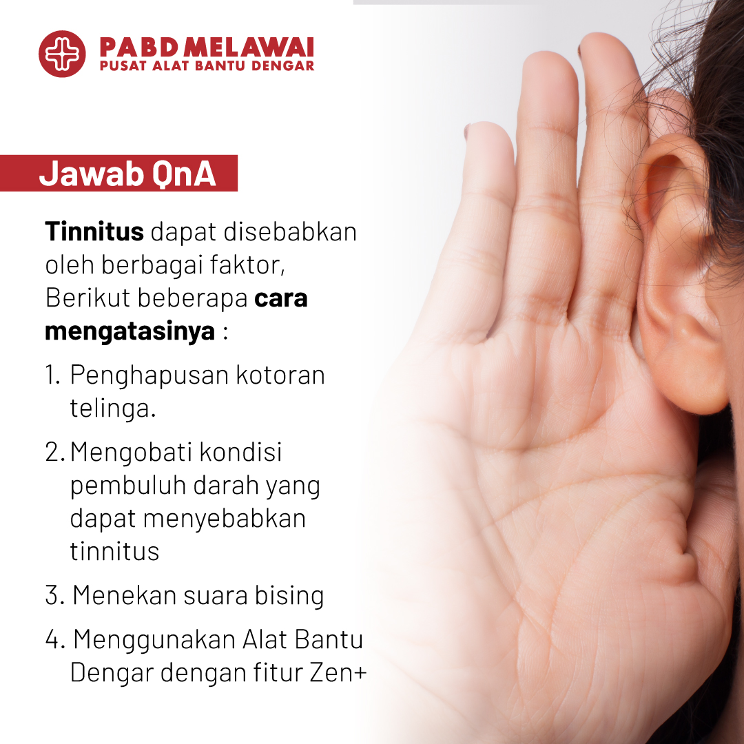 QnA Cara Mengatasi Tinnitus