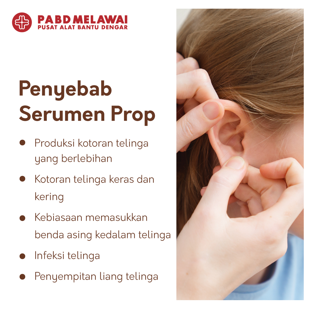 Penyebab Serumen Prop