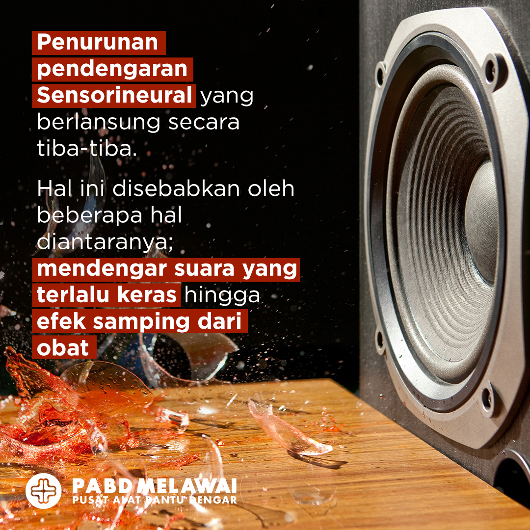 Trivia Penurunan pendengaran sensoneural