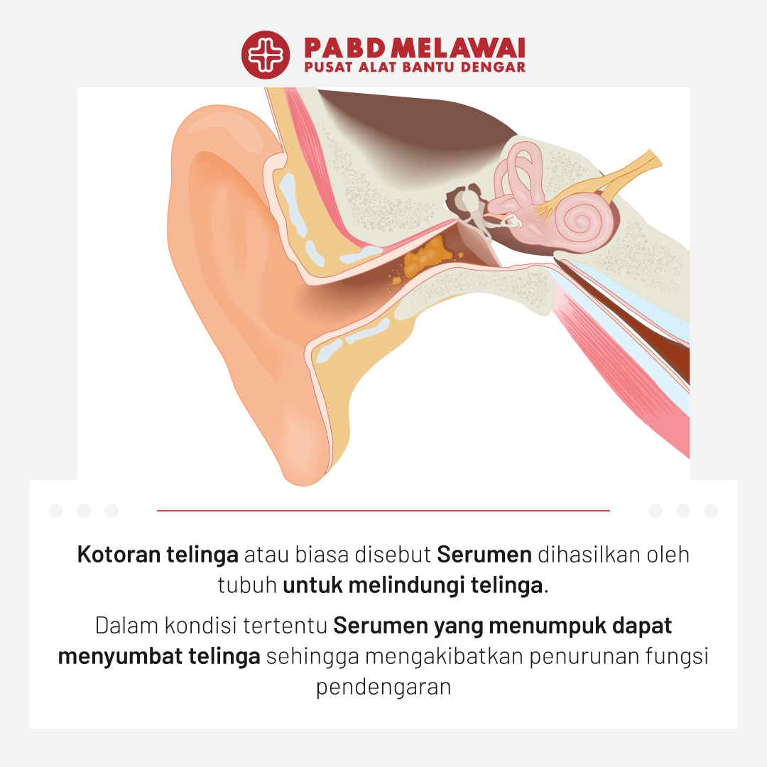 Plus Minus Kotoran Telinga, Yuk Cari Tahu