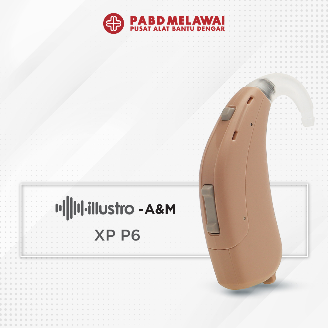 Alat Bantu Dengar Super Power, Illustro P6 XP