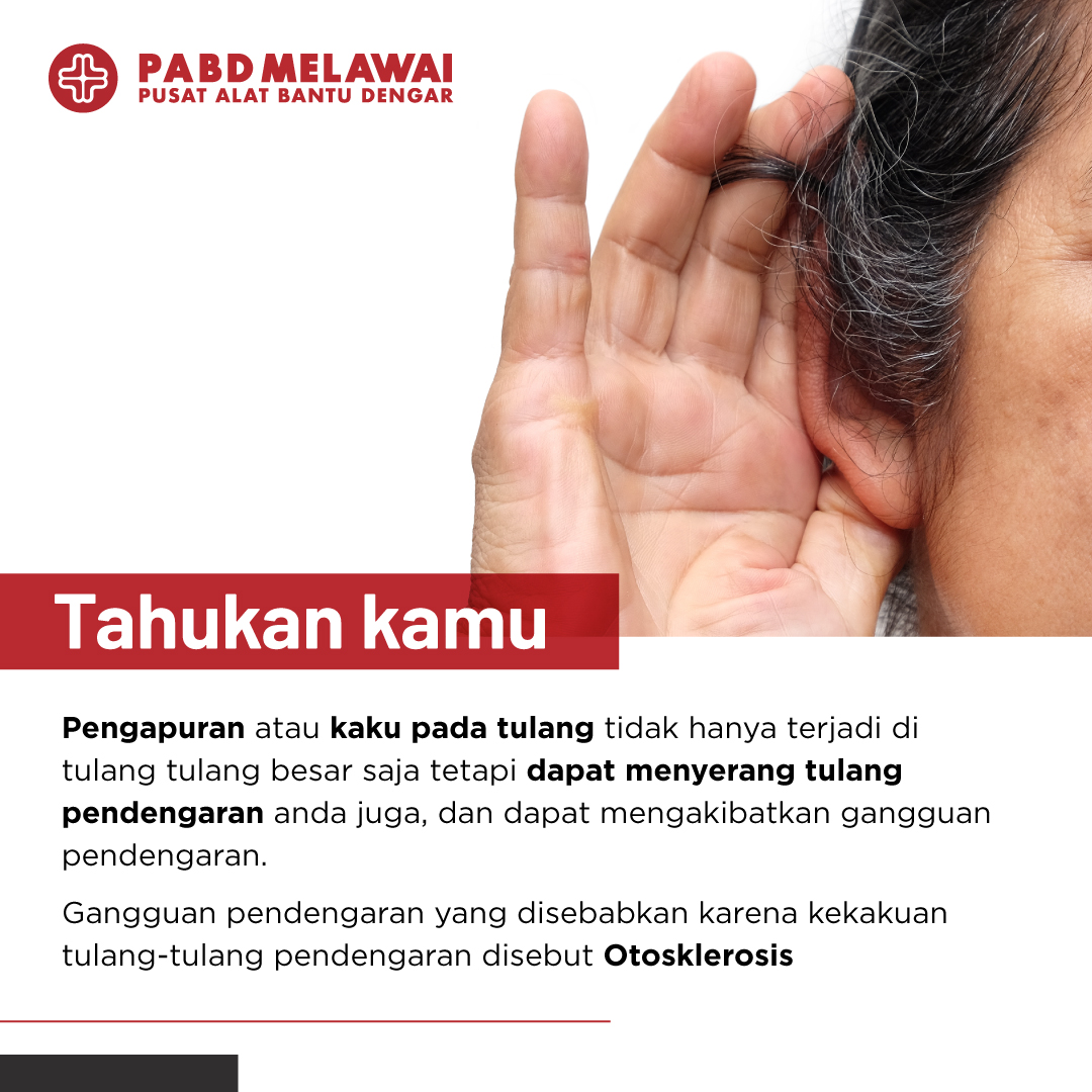 Otosklerosis Kenali salah satu gangguan pada telinga ini